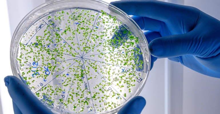 Autologous Stem Cell Hair Treatment