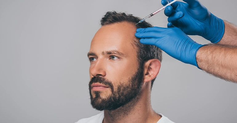 Exosome Hair Transplantation